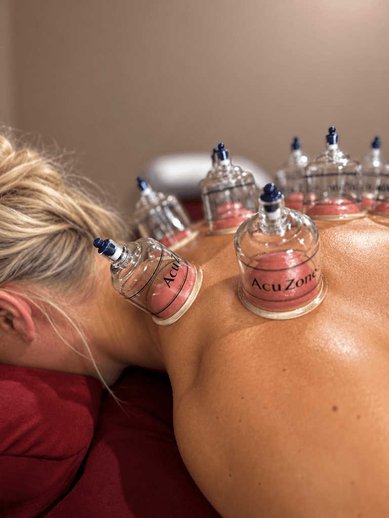 RM cupping service